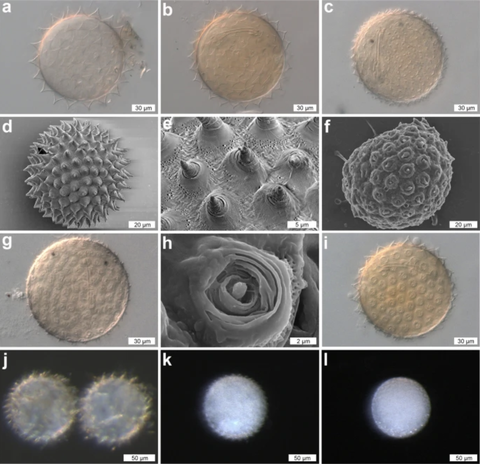 various ﻿dactylobiotus ovimutans﻿ eggs are shown, each displaying its own custom morphology