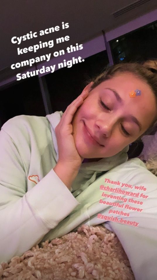 lili reinhart cystic acne selfie