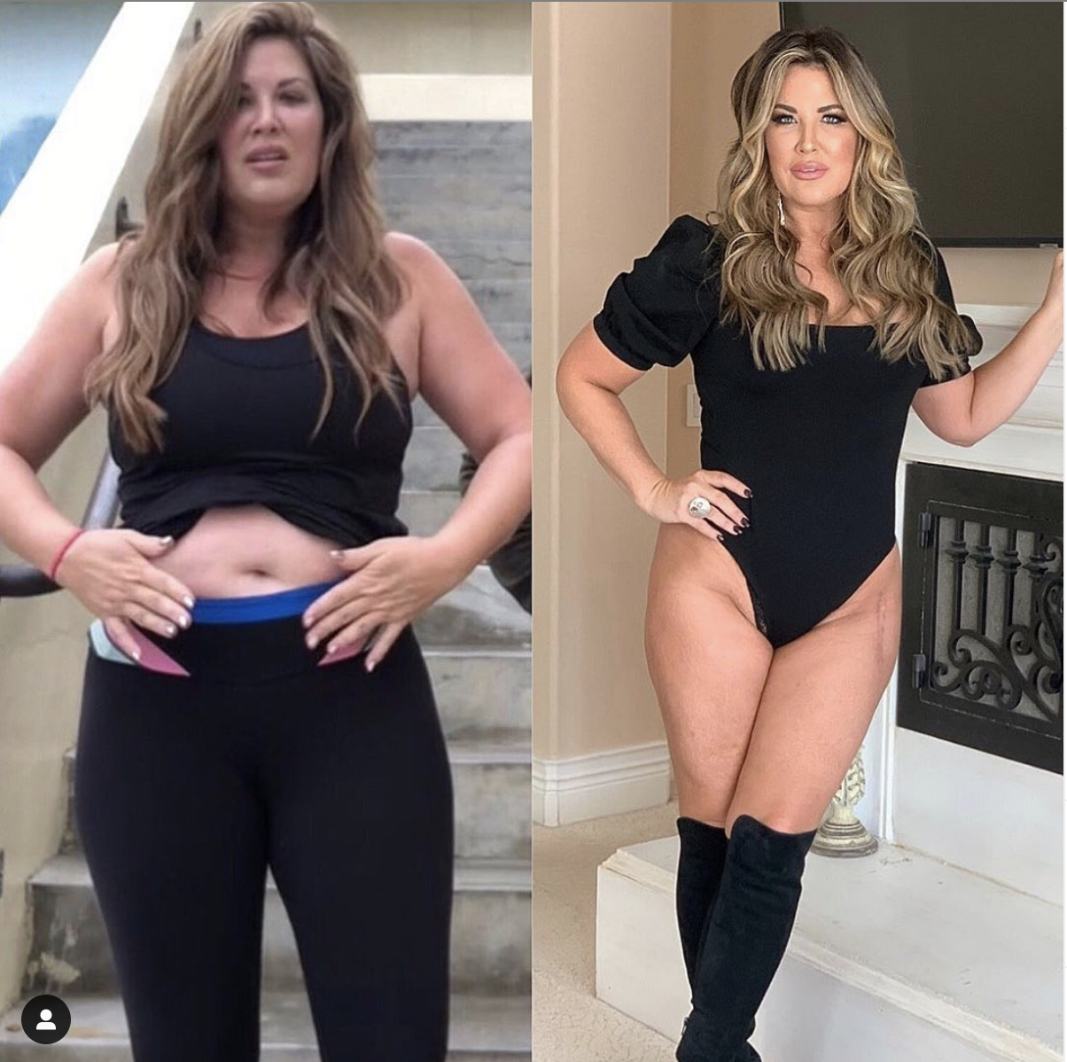 How Did Emily Simpson Lose Weight? RHOC Star Shows Weight Loss Photos picture