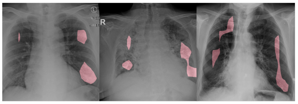 covid 19 cases from several different patients and their associated critical factors, highlighted in red ﻿
