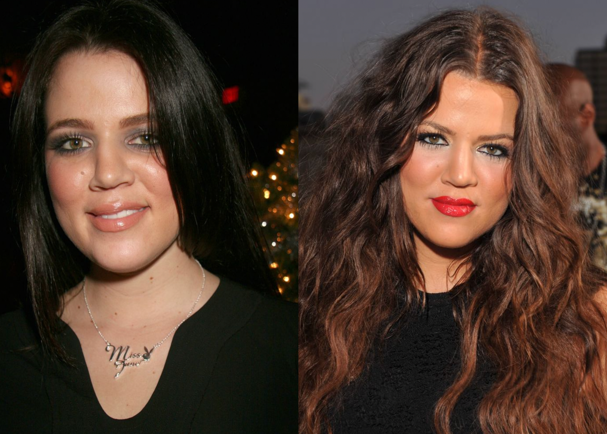 Khloé Kardashian's Gorgeous Before and After Photos