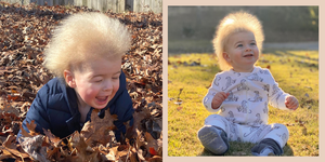 髪の毛が感電したように逆立ち、文字通り櫛でとかすこともできなくなってしまう「櫛でとかせない頭髪症候群（uhs）﻿﻿」。世界にわずか100例ほどしかないというこの症状、アメリカ・ジョージア州ロズウェル出身のロックラン・サンプルズくん（1歳）もそのうちの一人なんだそう――。