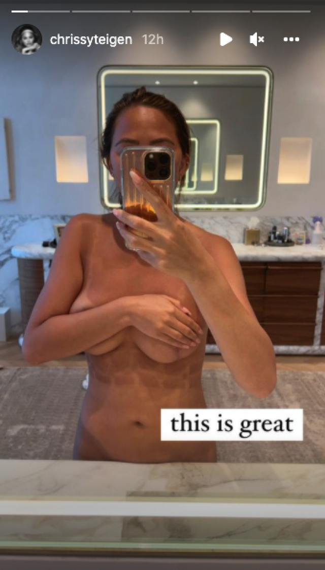 chrissy teigen tan