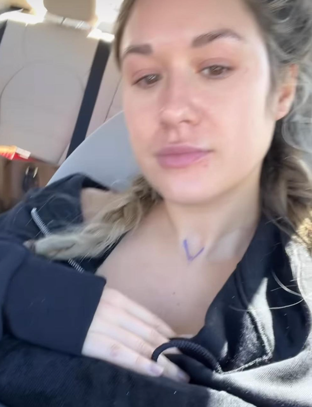 Bachelorette’s Rachel Recchia Gives Breast Reduction Surgery Update