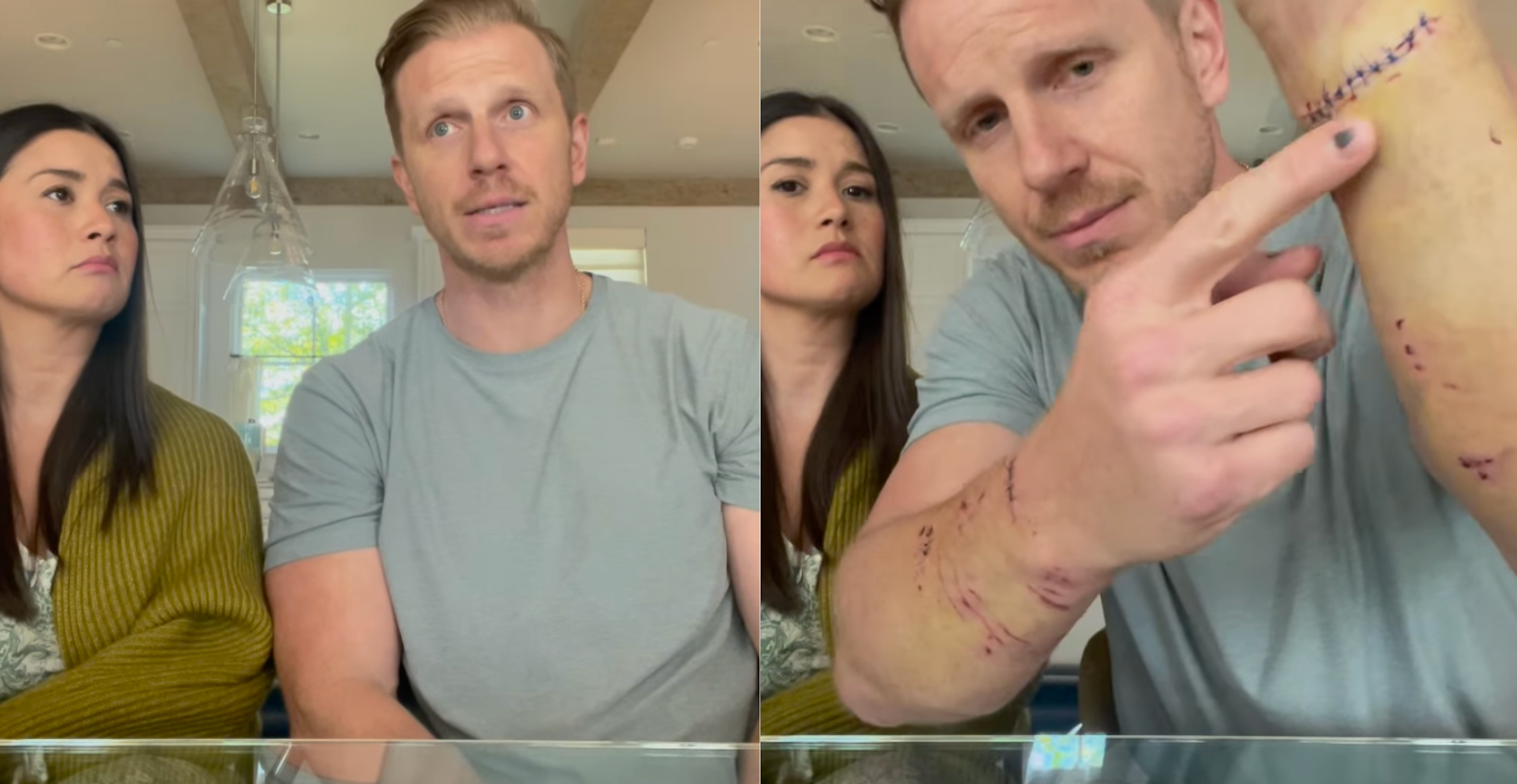 Bachelor Sean Lowe Recalls Attack by Family Dog in Instagram Video