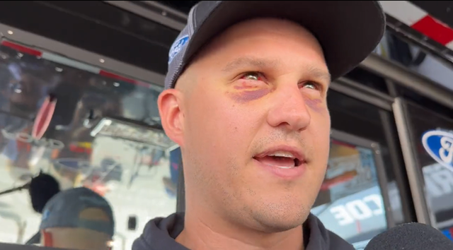 Ryan Preece Is Racing With What Look Like Burst Blood Vessels In His Eyes