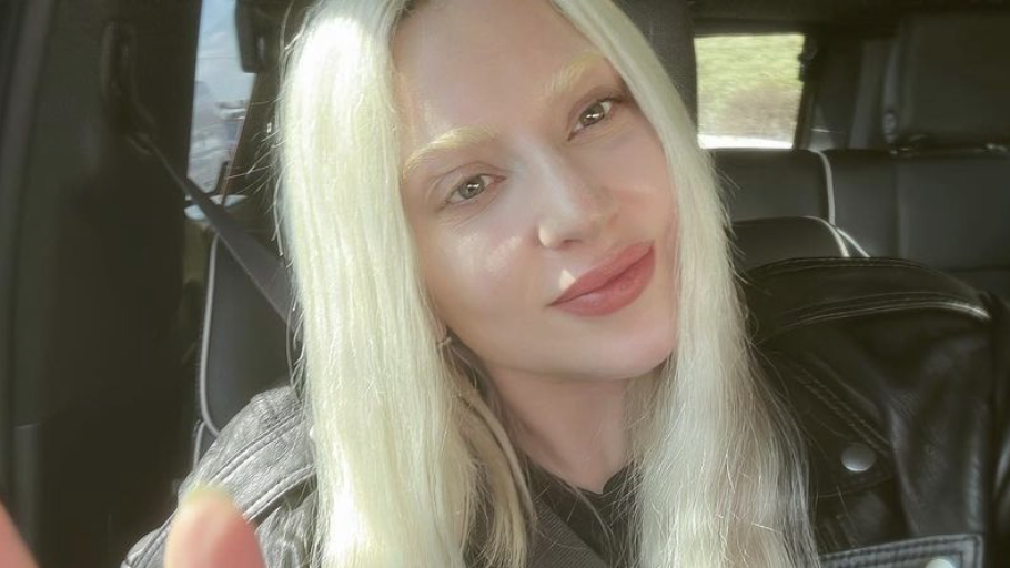 preview for Lady Gaga shows her natural skin texture in makeup-free video