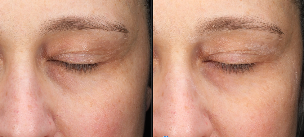 good housekeeping institute beauty lab mary kay instant eye depuffer before and after image
