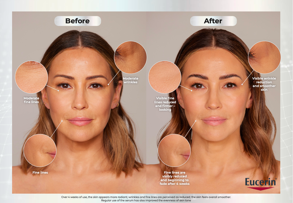 rachel stevens youth gene serum