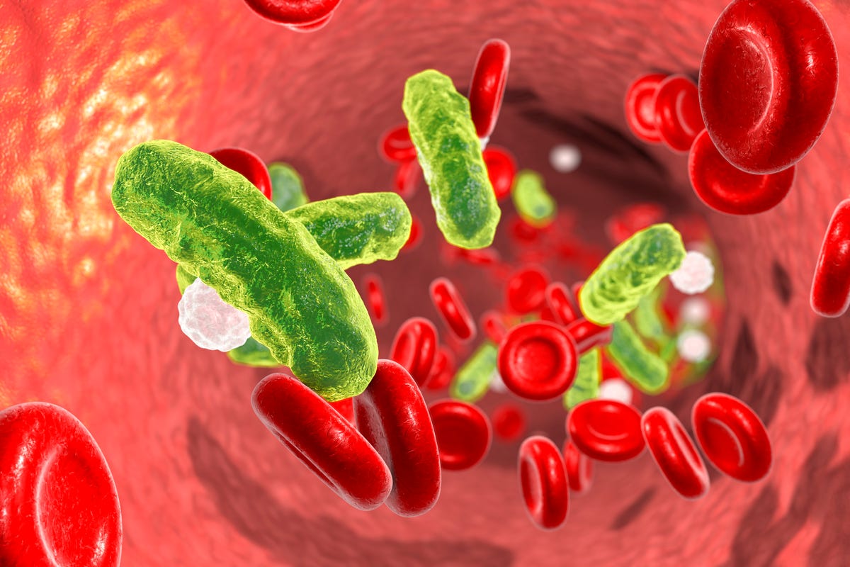 Sepsis Symptoms, Treatments & Causes - What Is Sepsis?