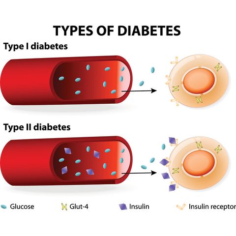 psoriasis and type 2 diabetes