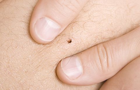 removing a tick