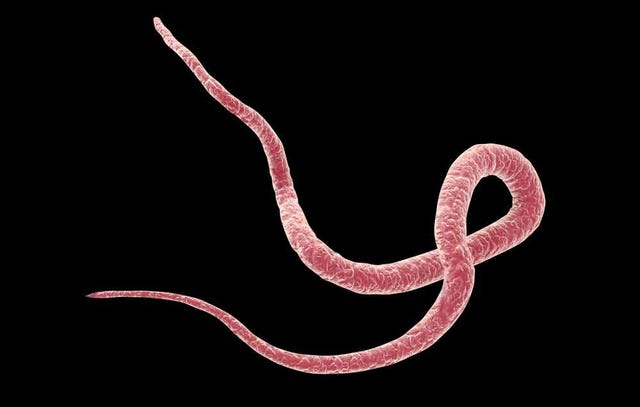 4 Reasons You Might Get A Parasite | Prevention