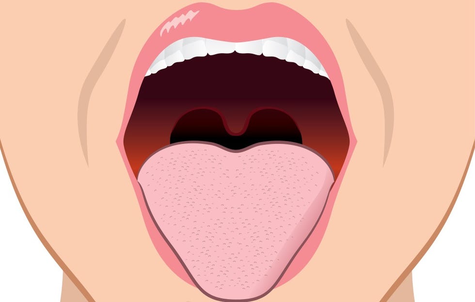 3 Health Issues You Can Blame On Your Tonsils | Prevention