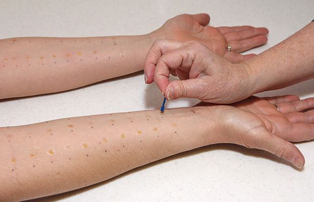 Skin test for allergies