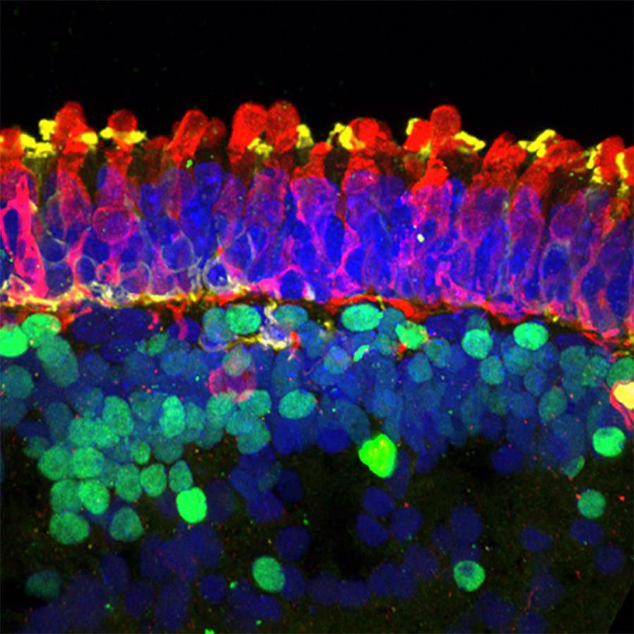 an organoid showing rods and cones and other retinal cells with different fluorescent markers