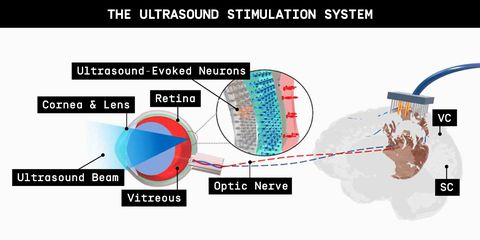 the ultrasound stimulation system for vision