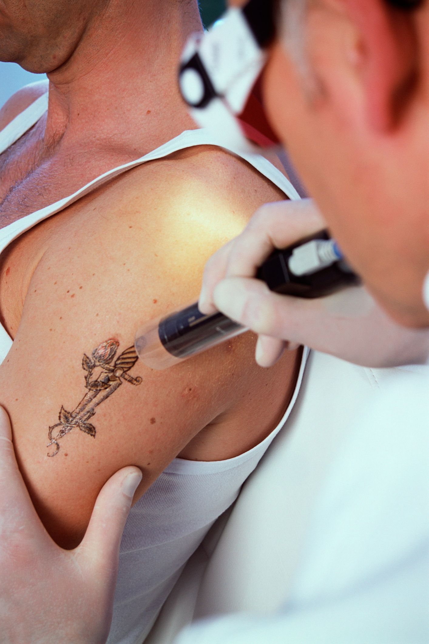 Infected Tattoos: 5 Things to Look For After Getting Inked