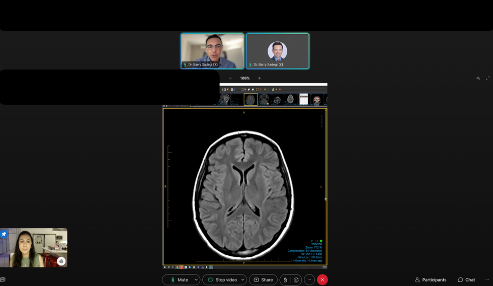 sassos mri results virtual call with radiologist