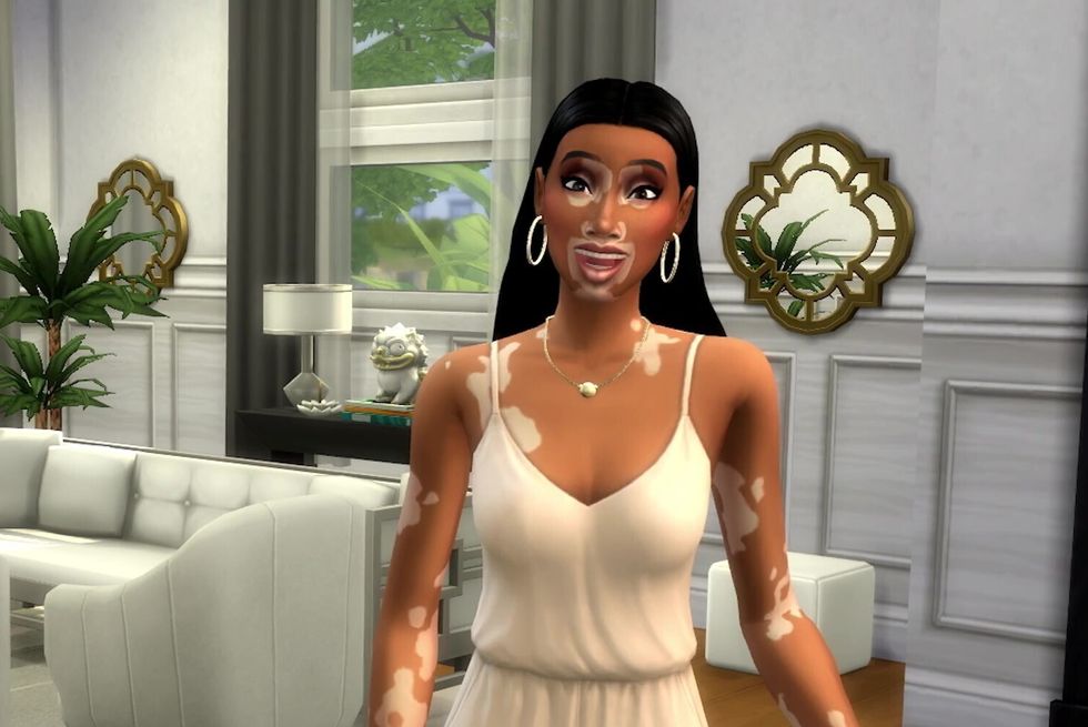 Actualización de la piel de vitíligo de los Sims 4