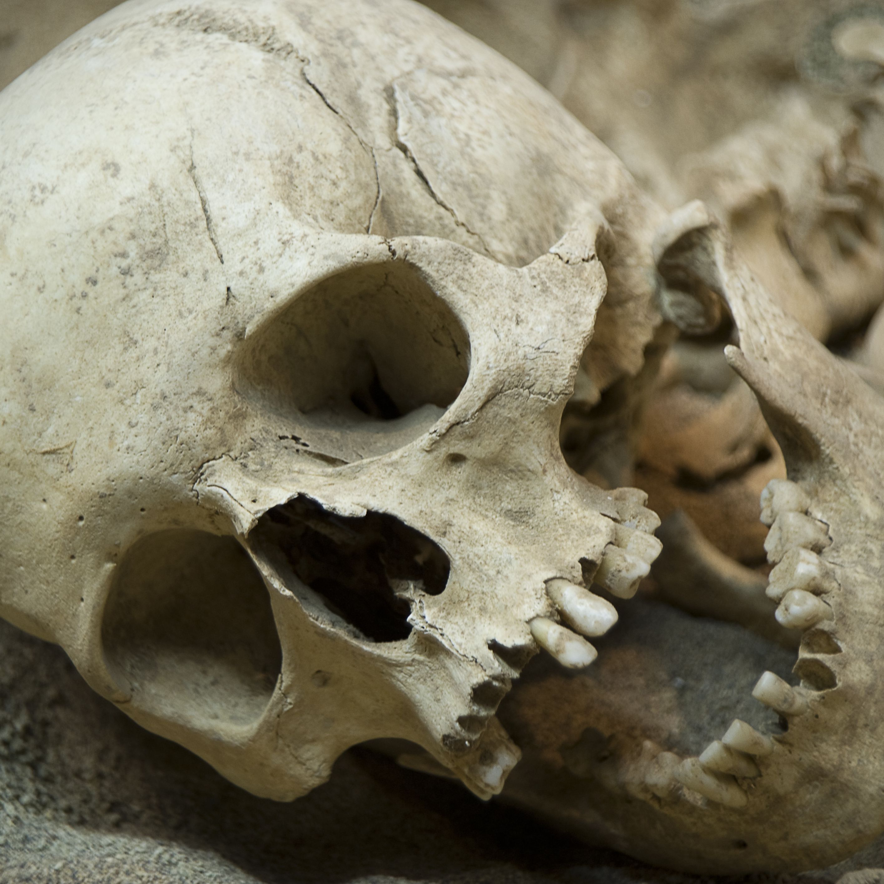 Archaeologists Were Digging Up a Hospital—and Found the Skeletons of 4 Confederate Soldiers