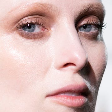 Crows feet treatments crows feet treatments