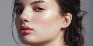 skin school everything you need to know about moles