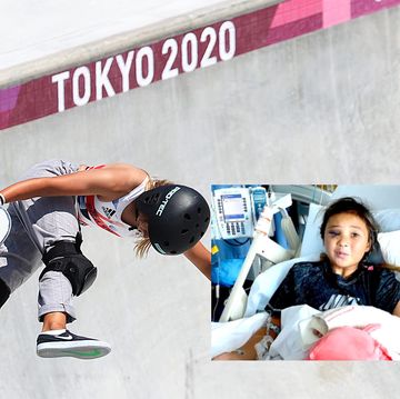 sky brown compite en tokio 2020 y consigue una medalla olímpica y una imagen de su estado tras un terrible accidente dos años antes
