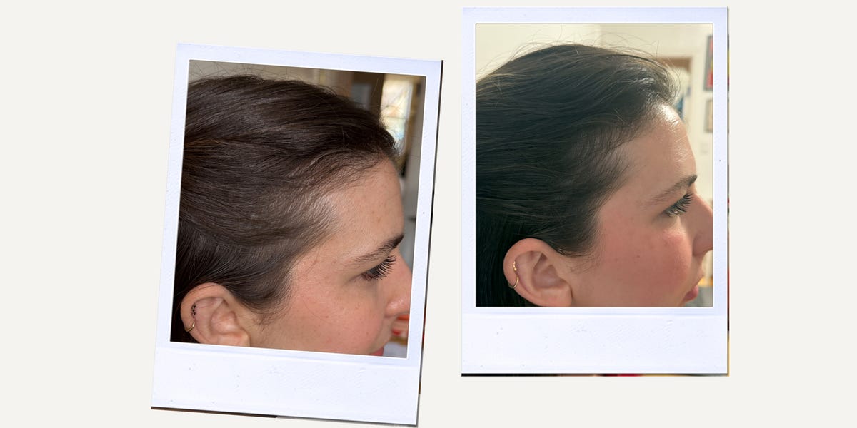 I Used This $78 Hair Growth Serum for 12 Weeks—Here’s ﻿What Happened