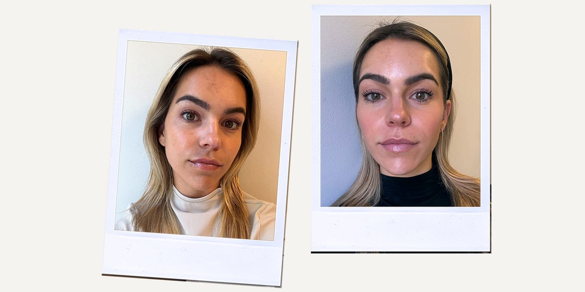 I Tried This Moisturizer for 12 Weeks While Using Tretinoin—Here’s What Happened