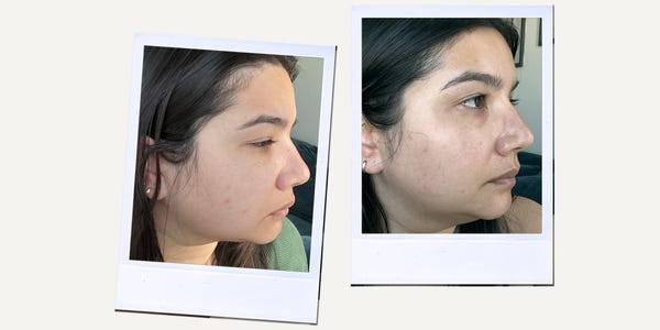 A testament to what efficacy and consistency can do.