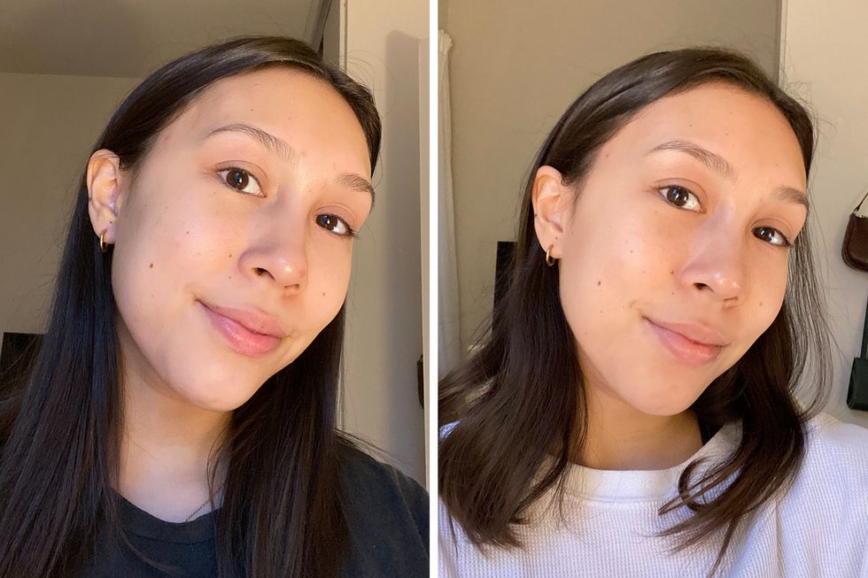 a before and after sidebyside photo of using the cosrx snail mucin essence after one to two weeks