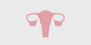 ovarian cancer