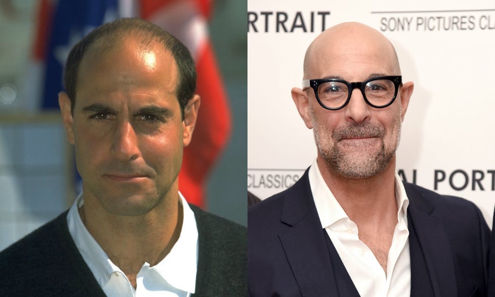 Как понять как ты будешь выглядеть лысым What Bald Actors Look Like Before and After Shaving