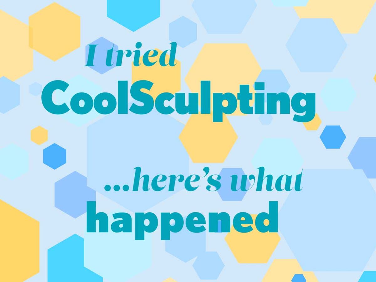 I Tried CoolSculpting — Here's My Before And After