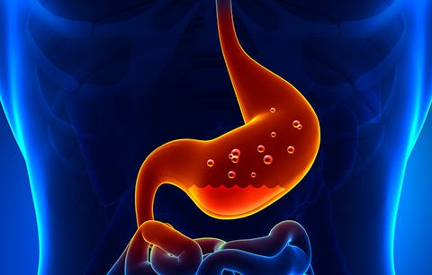 stomach acid reflux