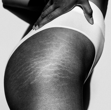 black and white picture of the stretch marks in the upper thigh of an anonymous black woman in white lingerie