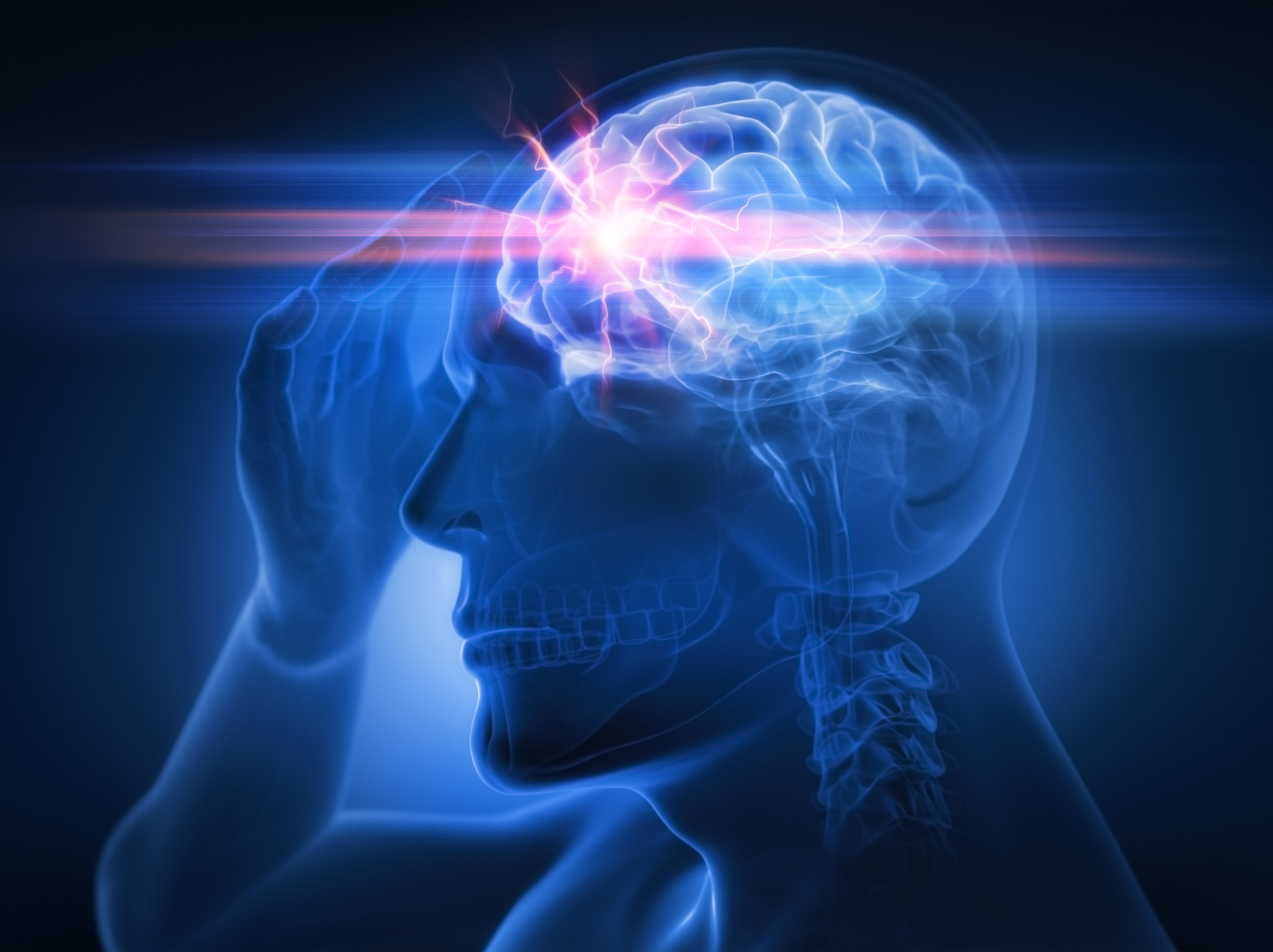 strong-headache-or-migraine-3d-illustration-royalty-free-image-1749230184.pjpeg