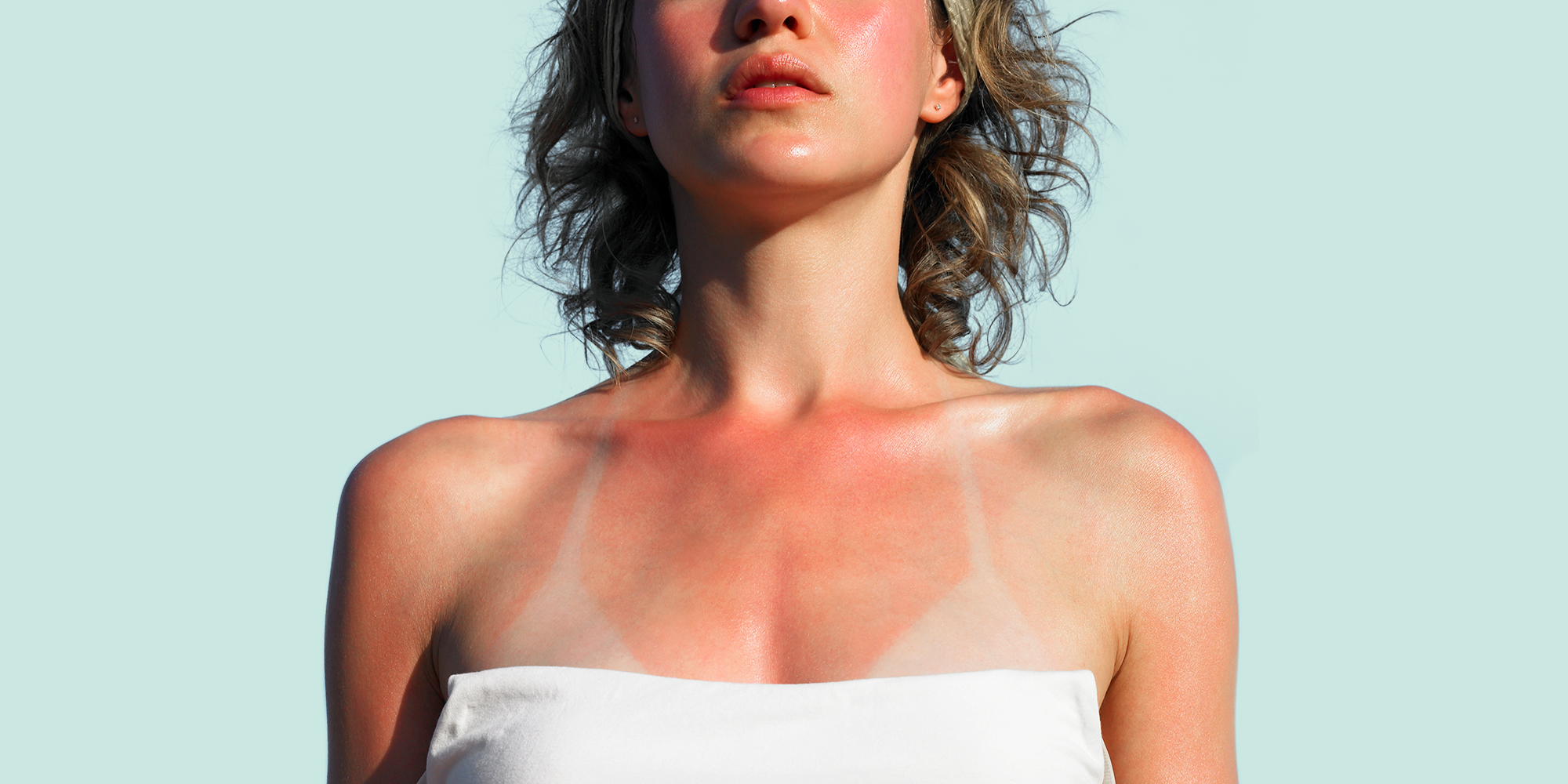 Natural sunscreens and natural treatment for sunburn! — Feelgood
