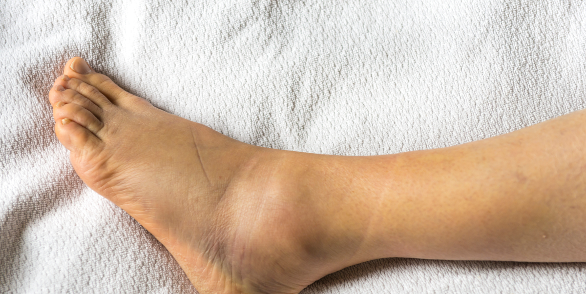 causes of swollen ankles