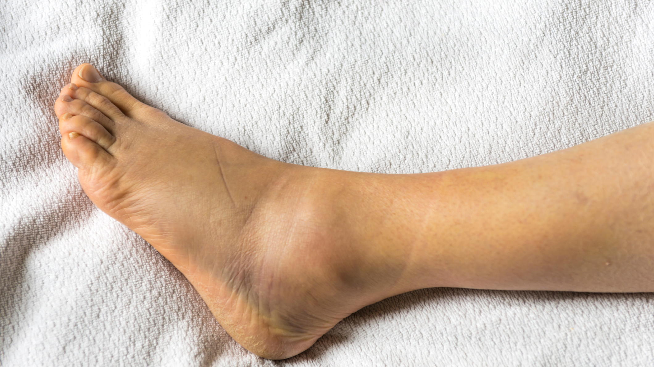 Got large feet? Know its causes and how to deal with it