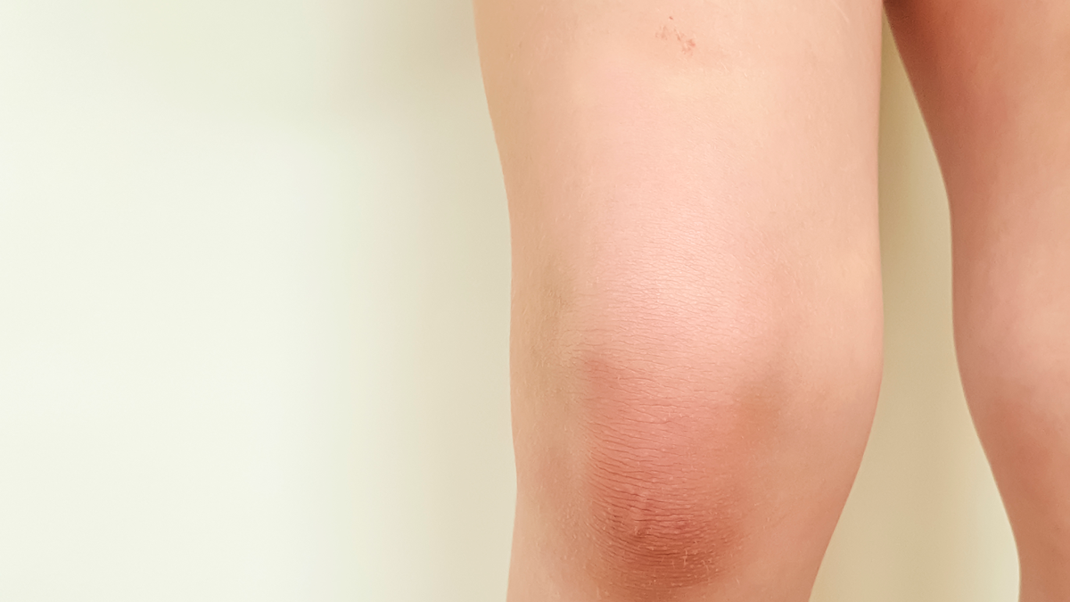 What's That Mysterious Pain In My Left Leg? Is It Dangerous? 