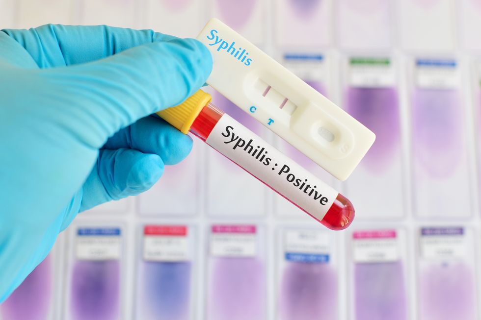 syphilis testing positive