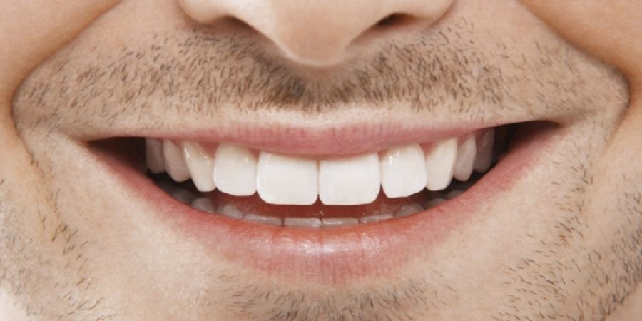 Tanden Bleken: Doen Of Niet?