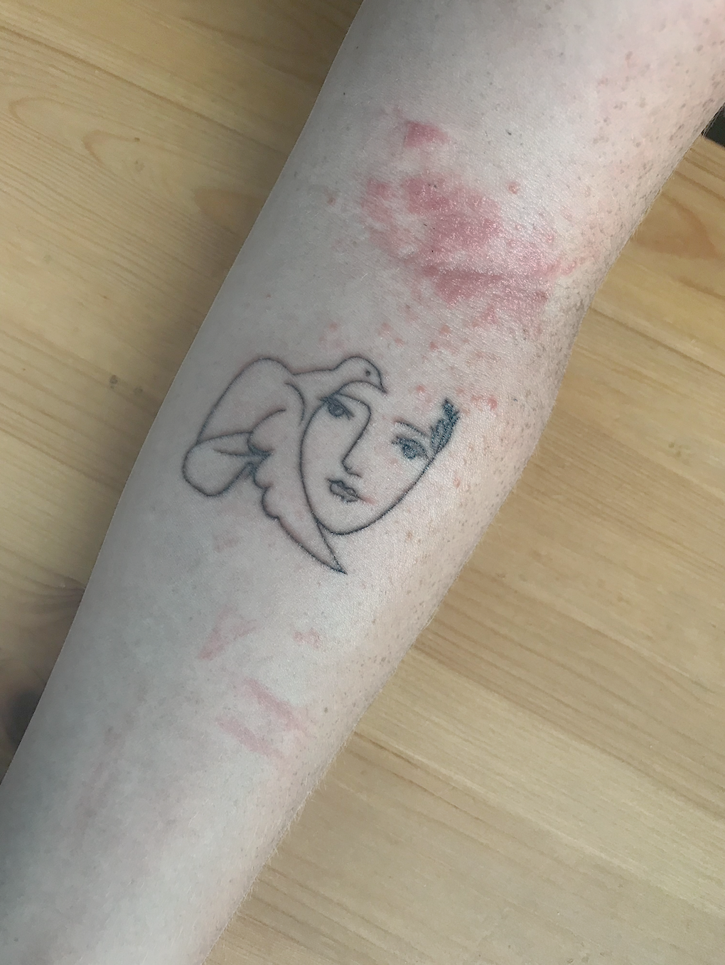 Tattoo Rash Signs You Might Have An Allergic Reaction