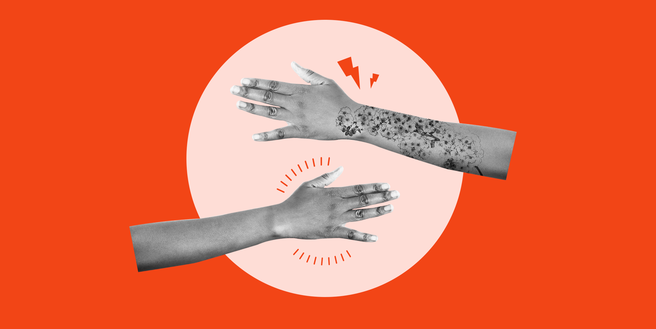 How Does Tattoo Removal Work? - U.S. Dermatology Partners