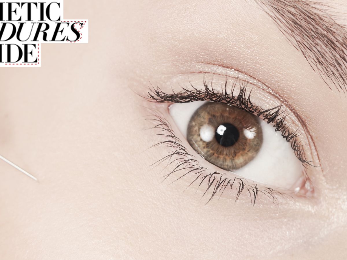 Under Eye Bags Surgery: A Quick Complete Guide