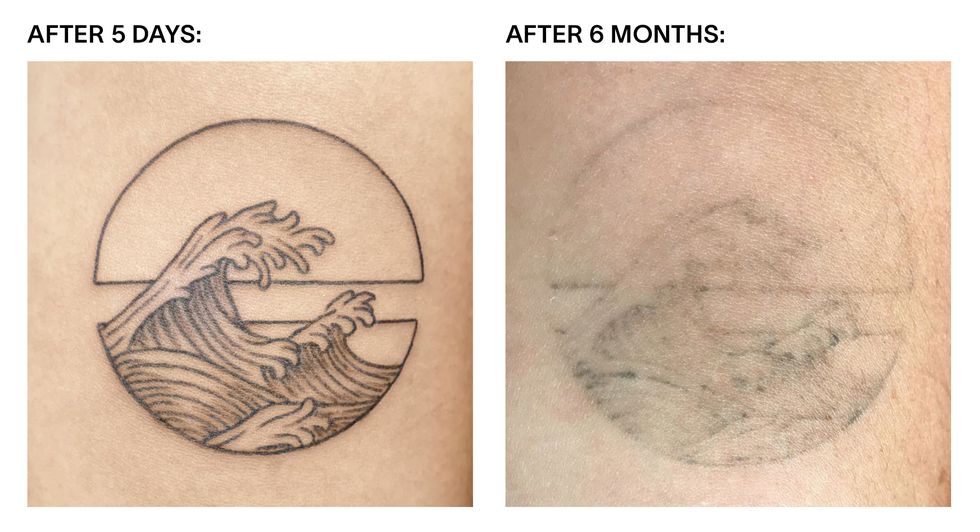 the progression of an ephemeral tattoo