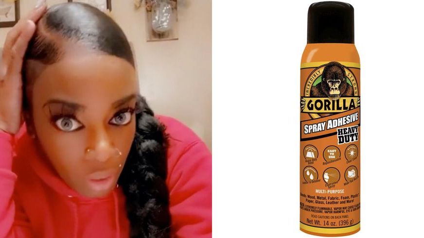 Gorilla Glue Girl' who accidentally stuck her hair to her head ends up in  hospital