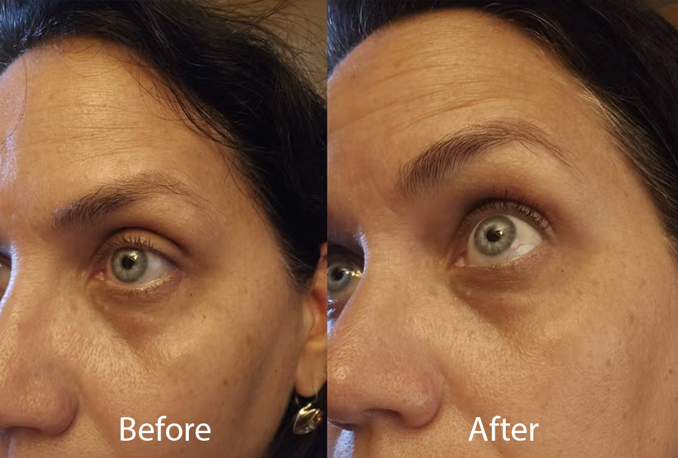 best dark spot correctors